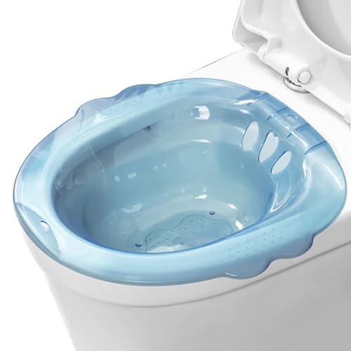 Baño Sitz para el inodoro, sobre el baño Sitz Bath para hemorroides, bidé portátil anti-superflujo con agujeros de drenaje, baños de sitz para hemorroides cuidados privados posparto (azul)
