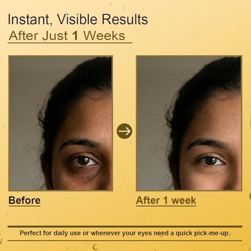 Image of Dr. Veda Under Eye Roll-On Cream for Dark Circles, Puffiness & Fine Lines | Eye Bag Remover | Cooling, Brightening & Hydrating Natural Formula | Anti-Wrinkle | For Men & Women | 10 ml