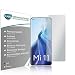 Produktbild Slabo 4 x Displayschutzfolie für Xiaomi Mi 11 (5G) Displayfolie Schutzfolie Folie Zubehör No Reflexion MATT