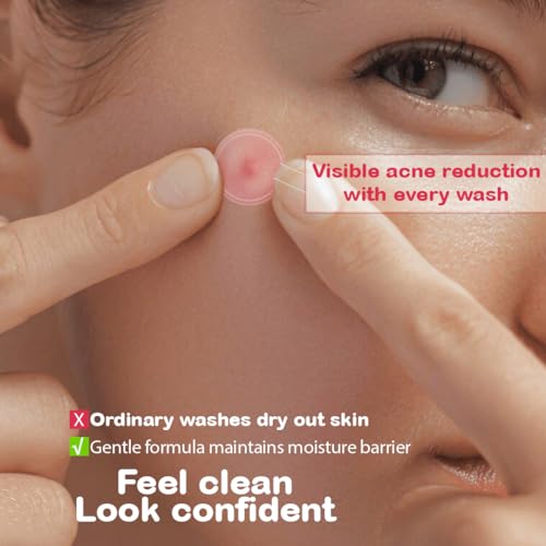 Image of Freeskin 5% Niacinamide Face Wash with Witch Hazel & Zinc PCA | Controls Excess Oil, Reduces Acne & Breakouts | Deep Cleansing for Visibly Luminous, Balanced Skin - 100 ml
