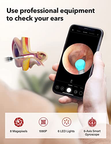 Bebird Pro Ear Wax Removal Tool With Hd Camera And 6 Led Lights,Ear Cleaner Expert For First Use And Smaller Ears,Fda Cleared Ear Camera And Wax Remover,For Ios,Android Phones #TOP1
