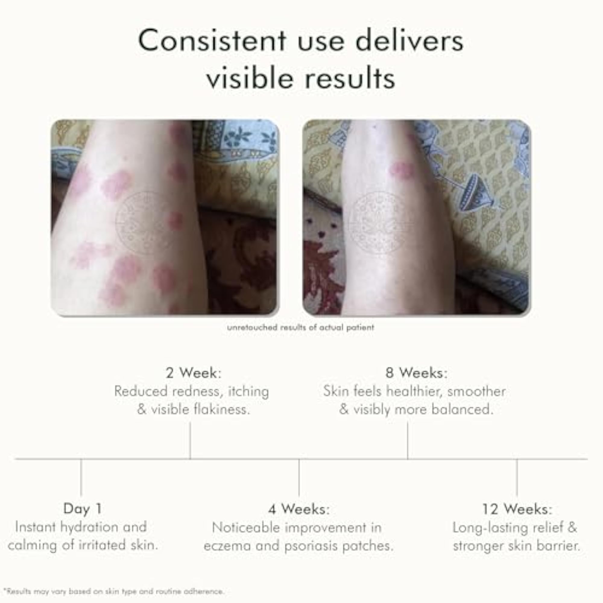 Natural Psoriasis Oil, 2-in-1 Relief