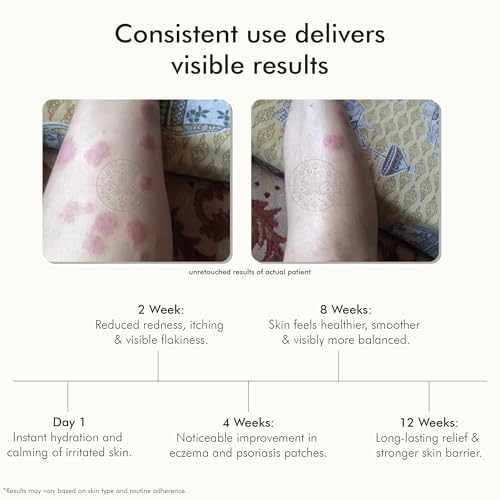 Image of VEDICDERM Natural Psoriasis Oil | 2-in-1 Skin + Scalp Relief for Skin Care Oil, Steroid-Free Formula for Dry, Itchy, and Flaky Skin, Helps Reduce Redness & Irritation, Promote Hydration (200ml Pack of 1)