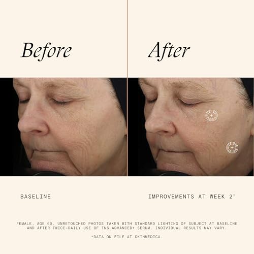 Thumbnail image for SkinMedica TNS Advanced+ Serum 