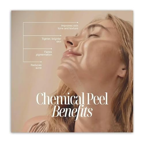 Chemical Peel Procedure And Benefits Guide Poster Canvas Painting For Esthetician Office(Framed,08x12inch(20x30cm))