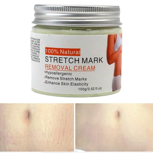 Crema De Embarazo, Lotión De Las Estrías, Bálsamo Del Vientre De Maternidad, Absorbente Rápido Y Ligero, Hidrata Y Suaviza La Piel, 2.32x2.32x2.48inc, Perfecto Para Mamá Y Hermana