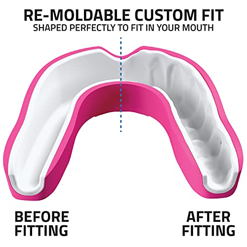 Paradenti sportivo in titanio (rosa, adulto (+12))...