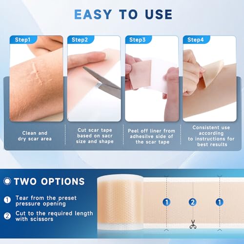 Image of Silicone Scar Sheets, Silicone Scar Tape(1.6 inch x 120 inch Roll 3M), Silicone Scar Sheets for Surgical Scars, Keloid Bump Removal, Stretch Marks Removal, C-Section, Burn et