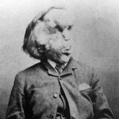 Joseph Merrick Beyond the Elephant Man