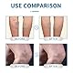 Varicose Veins Spray - Cream Against Varicose Veins & Vein Care Fading Cream Spray Against Spider Veins for Radiant Skin | Skin Whitening & Care 30 ml