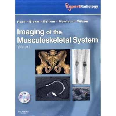Imaging of the Musculoskeletal System