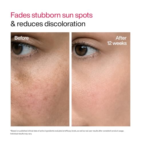 Image of WishCare Advanced Dark Spot Correcting Serum - TXA Shot | 10% Niacinamide Serum For Pigmentation and Dark Spot | With 2% Alpha Arbutin & TXA for Glowing Skin | 30ml