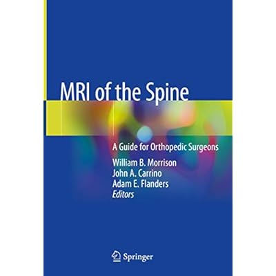 MRI of the Spine