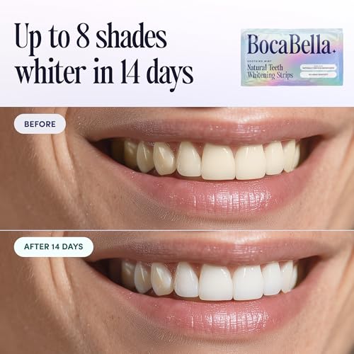 Natural Teeth Whitening Strips – Peroxide-Free, Enamel-Safe & Sensitivity-Free | 7 Treatments | Papaya & Pineapple Enzymes + Coconut Oil | Gentle Daily Stain Removal for a Brighter, Whiter Smile — view 4