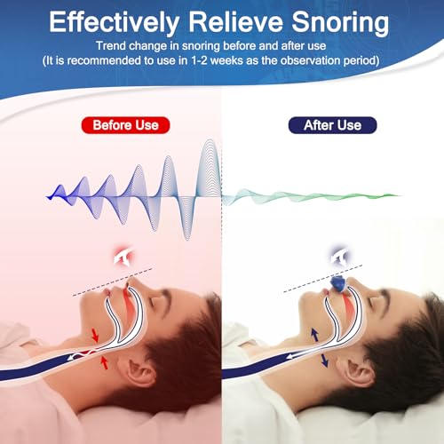 mini anti snoring devicesstop snoring reductionelectric anti snore deviceadjustable airflow snoring solution aids for men amp womenblue