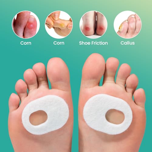 Image of Welnove 42Pcs Callus Pad with Water-Resistant Self-Stick Adhesive, Protects Foot, Heel and Toes from Rubbing and Friction,Oval Shape Design,Reduce Pressure and Friction from Shoes Rubbing-White