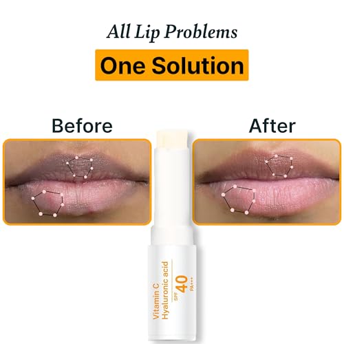 Image of Alanna Brightening Lip Balm SPF 40 PA+++ | For Dry, Dark, & Pigmented Lips | 1% Kojic Acid, Vitamin C, & Hyaluronic Acid | Protect from Sun Damage | Cocoa Butter | Vanilla Flavour