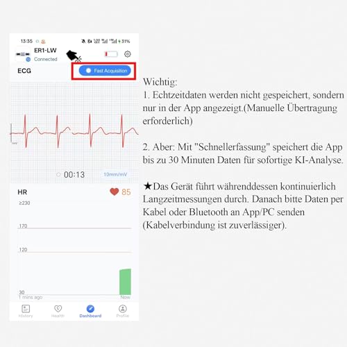 CheckMe ER1-LW 24 Stunden Langzeit EKG Gerät für Zuhause, AI-EKG Analyse EKG Monitor mit OLED-Bildschirm, EKG-Ereignismarker-Funktion, Kompatibel mit Allgemeine Elektrodenpads