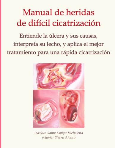 Manual de heridas de difícil cicatrización: Entiende la úlcera y sus causas, interpreta su lec...