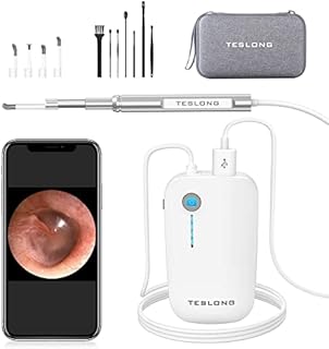 Teslong Digital Otoscope with Ear Wax Remover, Teslong Ear Camera with Ear Wax Removal Tools, Video Ear Scope Otoscope with Light for iPhone, iPad, Android Phone, USB, Ear Picks, Waterproof, 1080p HD