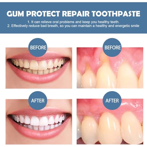 Zahnfleisch Therapie Gel, Reduziert Zahnfleischbluten, Zahnaufhellung Bleaching Stift, Gum Shield Therapy, Kontinuierliche Nutzung für Bessere Ergebnisse (2)