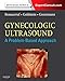 Gynecologic Ultrasound: A Problem-Based Approach