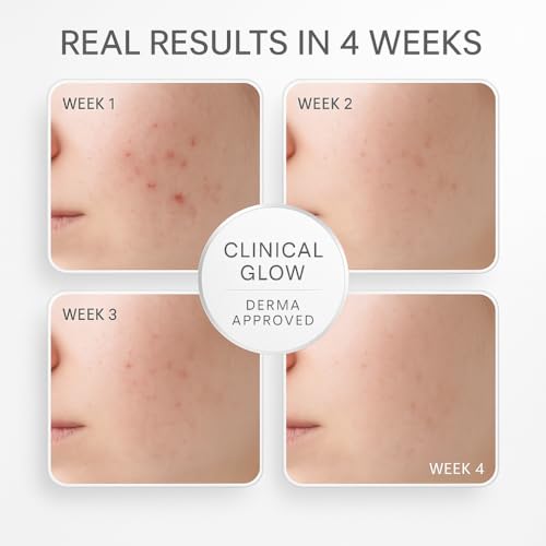 Image of 2% Kojic Acid Night Cream, Repairs and Brightens Damaged Skin, Glow with Science