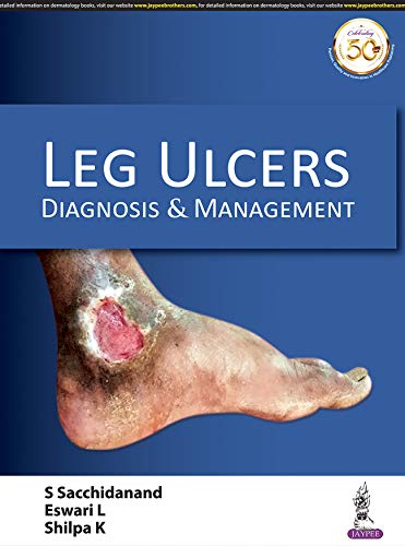 Leg Ulcers: Diagnosis and Management