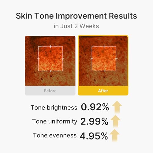 Image of medicube Capsule Cream with Kojic Acid & Turmeric for Uneven Skin Tone | Tone Renewal & Radiance Care with Turmeric, Kojic, Vitamin C, For troubled skin, Korean Skincare, 1.86 oz