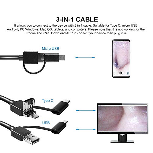 Eutuxia Endoscópio de limpeza de ouvido com luz LED e ferramenta de remoção de cera de ouvido Adequa