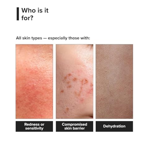 Image of Minimalist Barrier Repair Face Moisturizer with Vitamin B12 Complex 5.5% with Ceramides for All Skin Types | Strengthens Skin Barrier, Boosts Hydration, Soothing, Lightweight Gel Texture | 10 gm