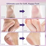 Foot Peel Mask 6 Pack, Exfoliator Foot Peel Mask for Dry Cracked Feet, Exfoliating Foot Mask for Callus, Dead Skin Removal, Baby Soft Feet For Men Women (Lavender) - Image 3