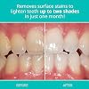 Opalescence Whitening Toothpaste for Sensitive Teeth (1 Pack) - Oral Care, Mint Flavor, Gluten Free - TP-5167-1