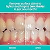 Opalescence Whitening Toothpaste for Sensitive Teeth (1 Pack) - Oral Care, Mint Flavor, Gluten Free - TP-5167-1