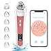 Produktbild Mitesserentferner Porensauger Vakuumsauger Mitesser Sauger Porenreiniger Pickelsauger Gesichtsreinigung Pickelentferner Gesichtsporenreiniger Blackhead Remover Vacuum mit 6 austauschbaren Saugspitzen