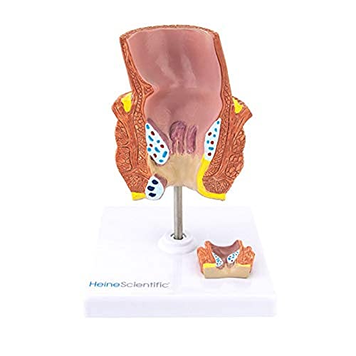 HeineScientific Hämorrhoiden-Modell