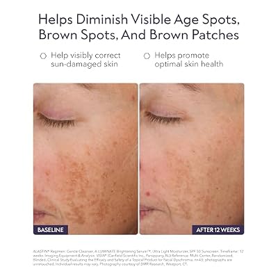 ALASTIN Skincare A-LUMINATE Face Serum (1.7 oz) | Hydrating Formula that Helps Visibly Smooth Skin Texture & Enhance Radiance for a More Youthful Appearance