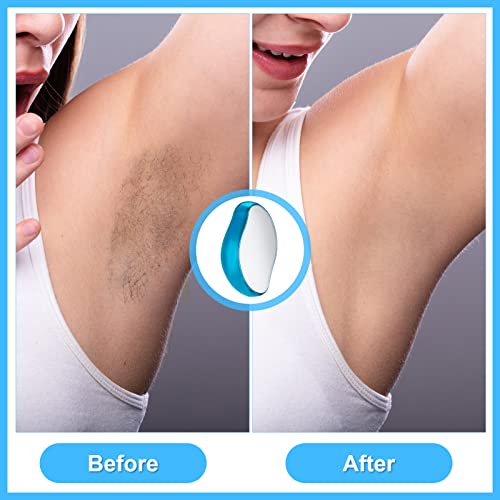 Nano Haarentferner, Haarentfernung Ohne Rasieren, Schmerzen & Schneiden, Crystal Haarentferner mit 1 Dusche Handschuh… - Image 3
