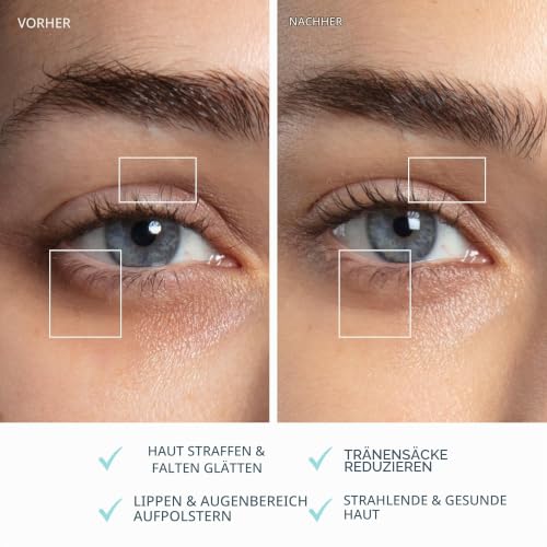 FOREO BEAR 2 Eyes & Lips - Massagegerät gegen Falten für sofortige Gesichtsstraffung - Augenmassagegerät - Augenbrauenlifting - Behandlung… – Ansicht 5