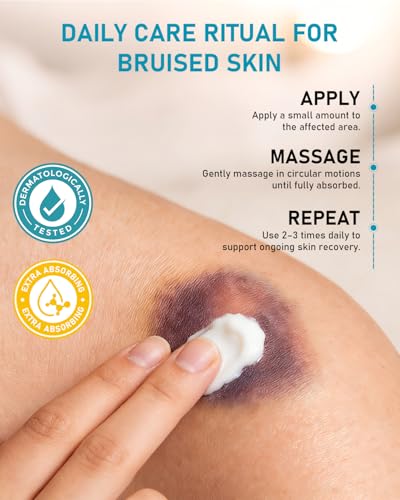XUEBEIK Arnica Bruise Cream with Vitamin K, Non-Greasy for Thin Skin, 6 oz — view 6