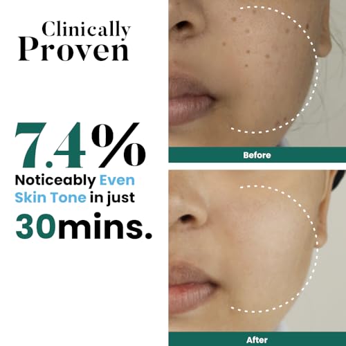 Image of Bio Code 1.5% Alpha Arbutin Brightening Moisturizer (100ml) - with 1% Tranexamic Acid, 1% Licorice & 2% Niacinamide | For Even Tone & Deep Hydration | AI-Enhanced Formula | Dermatologist Recommended