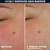 RoC Barrier Renew Day Cream with SPF 30, Moisturizer with Ceramides & Prebiotics to Protect Skin Barrier, (2.5 oz) with Retinol Eye Cream Packette