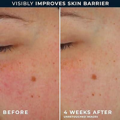 RoC Barrier Renew Day Cream with SPF 30, Moisturizer with Ceramides & Prebiotics to Protect Skin Barrier, (2.5 oz) with Retinol Eye Cream Packette