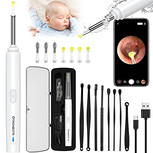 Ear Wax Removal Tool, Ear Cleaner with 1296P PHD Camera, Ear Cleaning Kit with Lights, Ear Otoscope Compatible with iPhone, iPad, and Android((White)