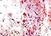 KT 025-100 - Oil Red O Histology Stain Kit, Diagnostic Biosystems - Each
