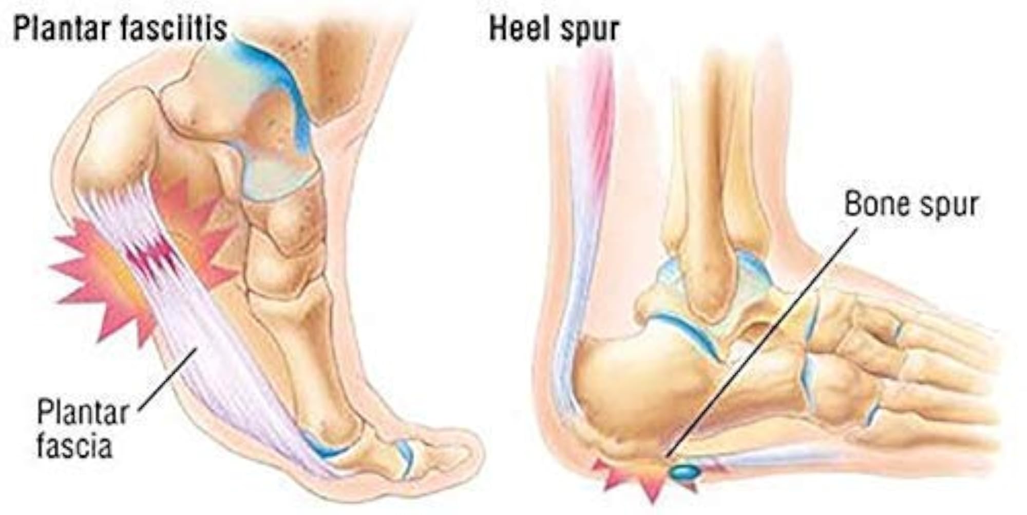 Heel Pain Relief Silicone Gel Heel Socks