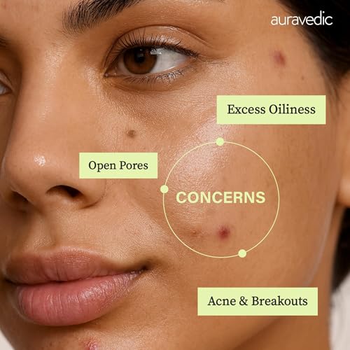 Image of Auravedic Face Pack For Acne And Dark Spots 100 G Clay Mask For Oily Acne Prone Skin Face Pack For Women With Tea Tree Oil Azelaic Acid Chamomile Gotu Kola Niacinamide And Hyaluronic Acid