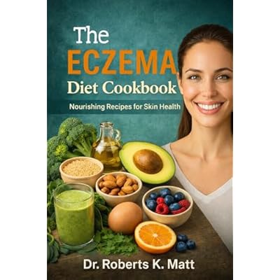 The Eczema Diet Cookbook