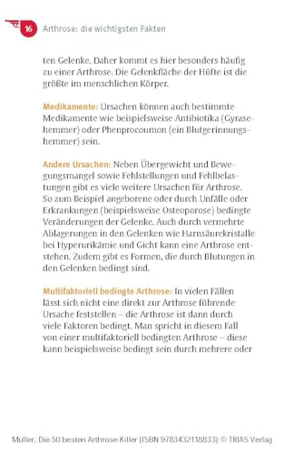 Die 50 besten Arthrose-Killer