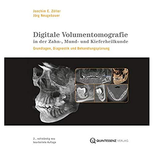 Preisvergleich Produktbild Digitale Volumentomografie in der Zahn-, Mund- und Kieferheilkunde: Grundlagen, Diagnostik und Therapieplanung